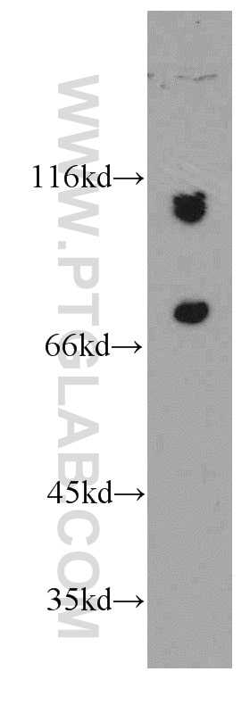 Western Blot (WB) analysis of A2780 cells using SMEK2 Polyclonal antibody (20348-1-AP)