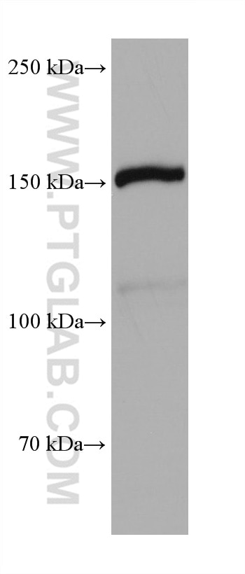 SMG6