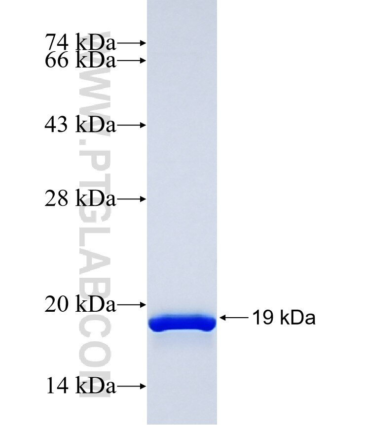 SMG6 fusion protein Ag34198 SDS-PAGE
