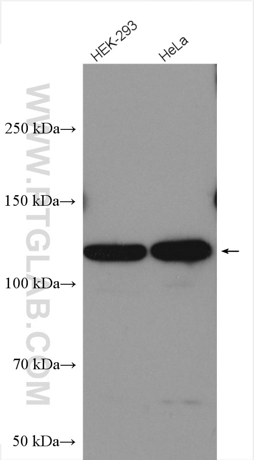 Western Blot (WB) analysis of various lysates using SMG8 Polyclonal antibody (28040-1-AP)