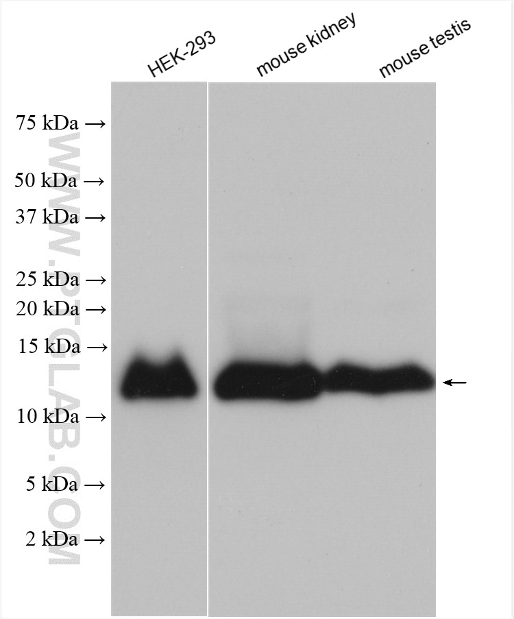 Western Blot (WB) analysis of various lysates using SMIM1 Polyclonal antibody (27849-1-AP)
