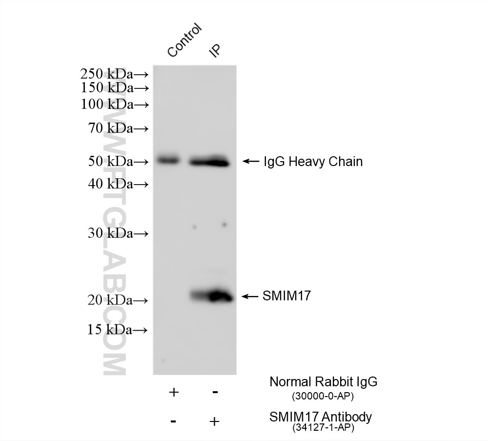IP experiment of rat brain using 34127-1-AP Immunoprecipitation (IP) experiment of rat brain tissue using SMIM17 Polyclonal antibody (34127-1-AP)