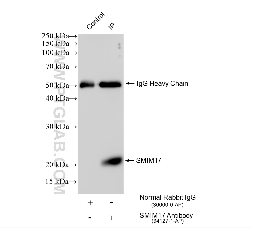 IP experiment of mouse brain using 34127-1-AP Immunoprecipitation (IP) experiment of mouse brain tissue using SMIM17 Polyclonal antibody (34127-1-AP)