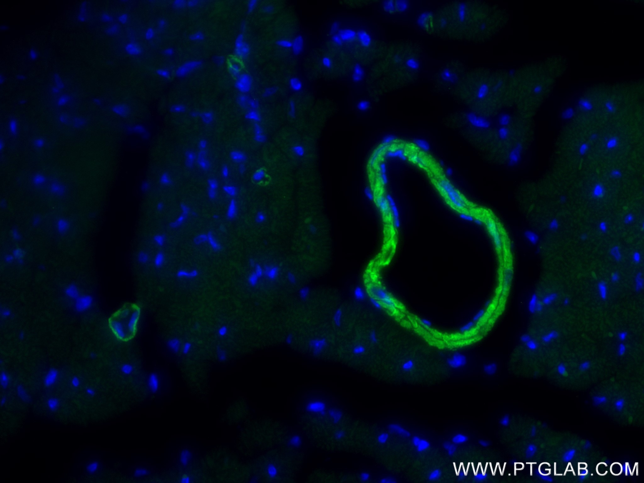 Immunofluorescence (IF) / fluorescent staining of mouse heart tissue using SMMHC Recombinant monoclonal antibody (86654-3-RR)
