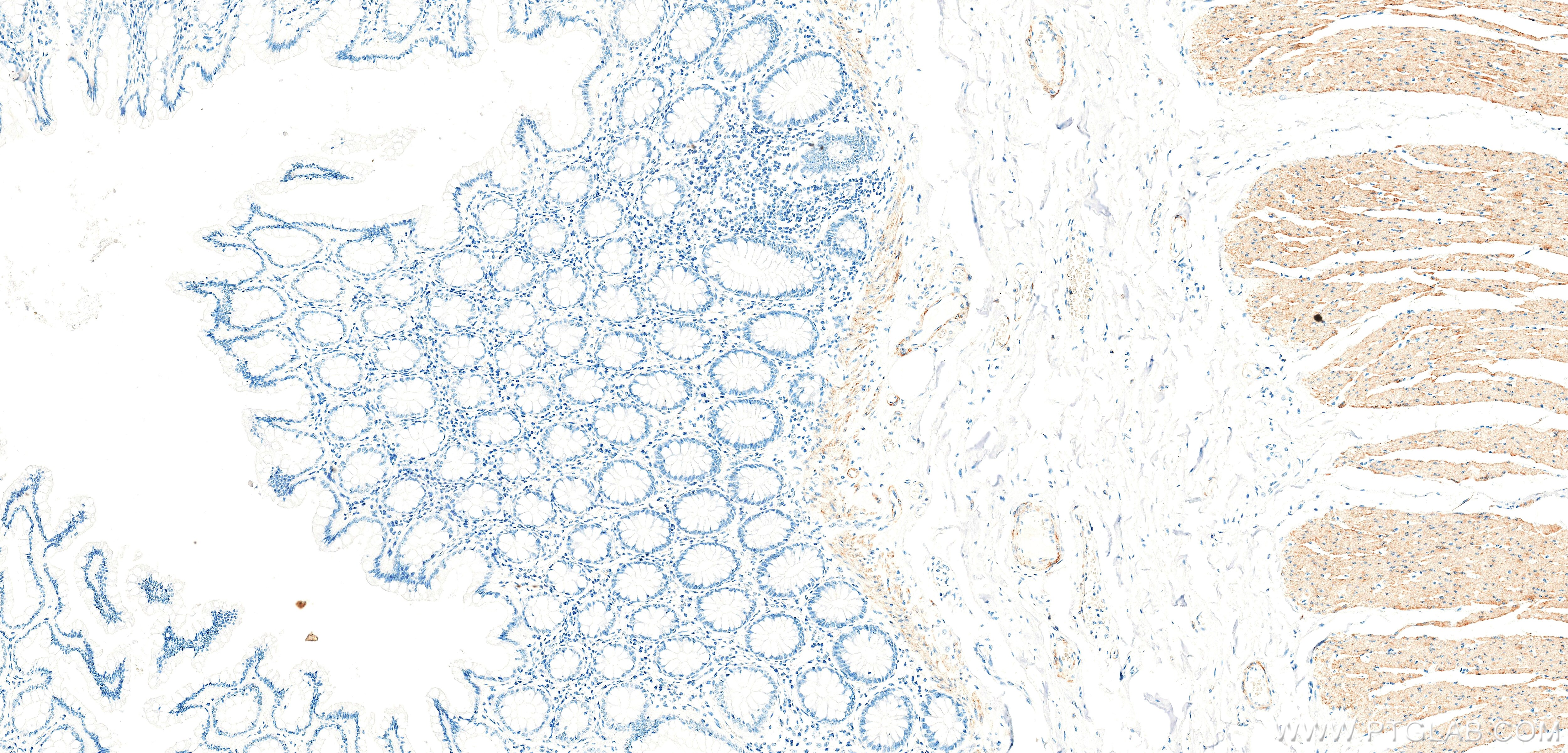 IHC staining of human colon using 86654-3-RR Immunohistochemistry (IHC) staining of human colon tissue using SMMHC Recombinant monoclonal antibody (86654-3-RR)