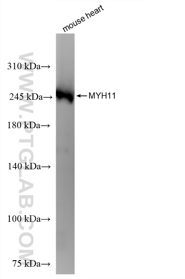 WB analysis of mouse heart using 86654-3-RR Western Blot (WB) analysis of mouse heart tissue using SMMHC Recombinant monoclonal antibody (86654-3-RR)