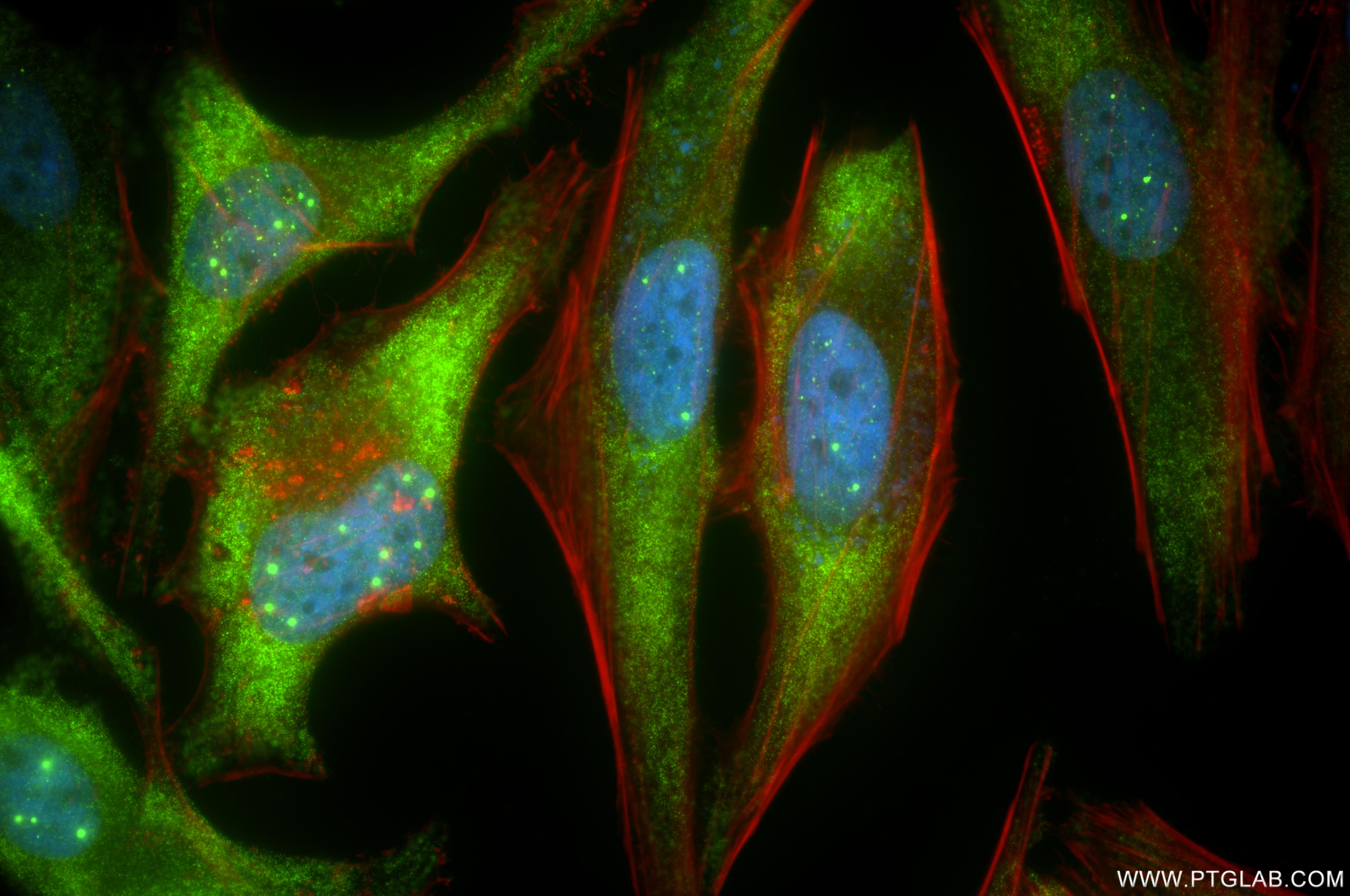 IF Staining of HeLa using 86668-2-RR Immunofluorescence (IF) / fluorescent staining of HeLa cells using SMN Recombinant monoclonal antibody (86668-2-RR)