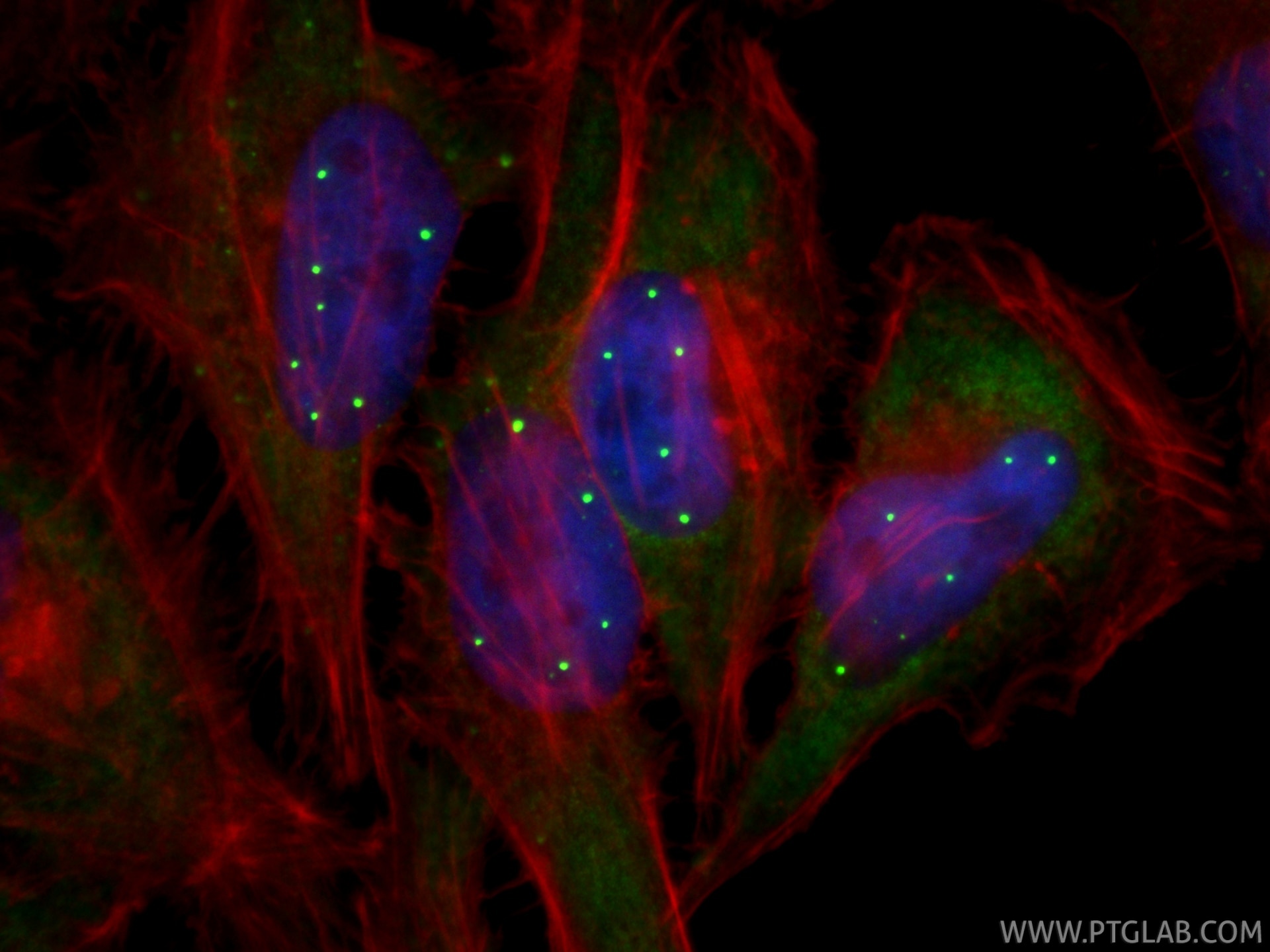 IF Staining of HeLa using 86668-2-RR Immunofluorescence (IF) / fluorescent staining of HeLa cells using SMN Recombinant monoclonal antibody (86668-2-RR)