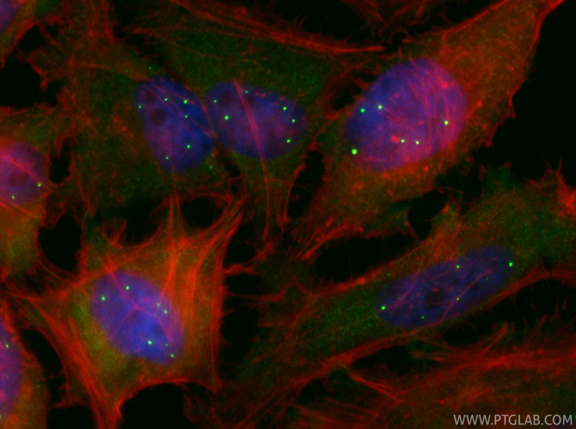 IF Staining of HeLa using CL488-86668-2 Immunofluorescence (IF) / fluorescent staining of HeLa cells using CoraLite® Plus 488-conjugated SMN Recombinant mono (CL488-86668-2)