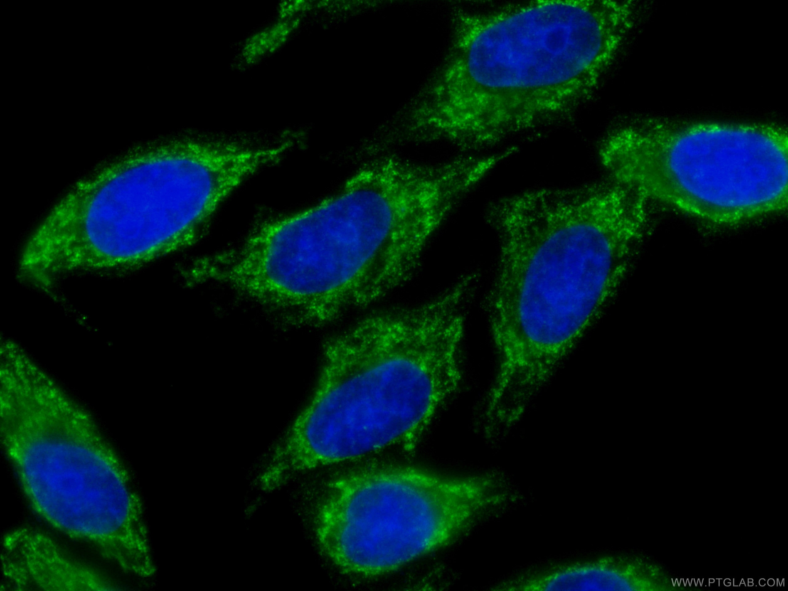 Immunofluorescence (IF) / fluorescent staining of HepG2 cells using CoraLite® Plus 488-conjugated SMN-Exon7 Monoclonal (CL488-60255)