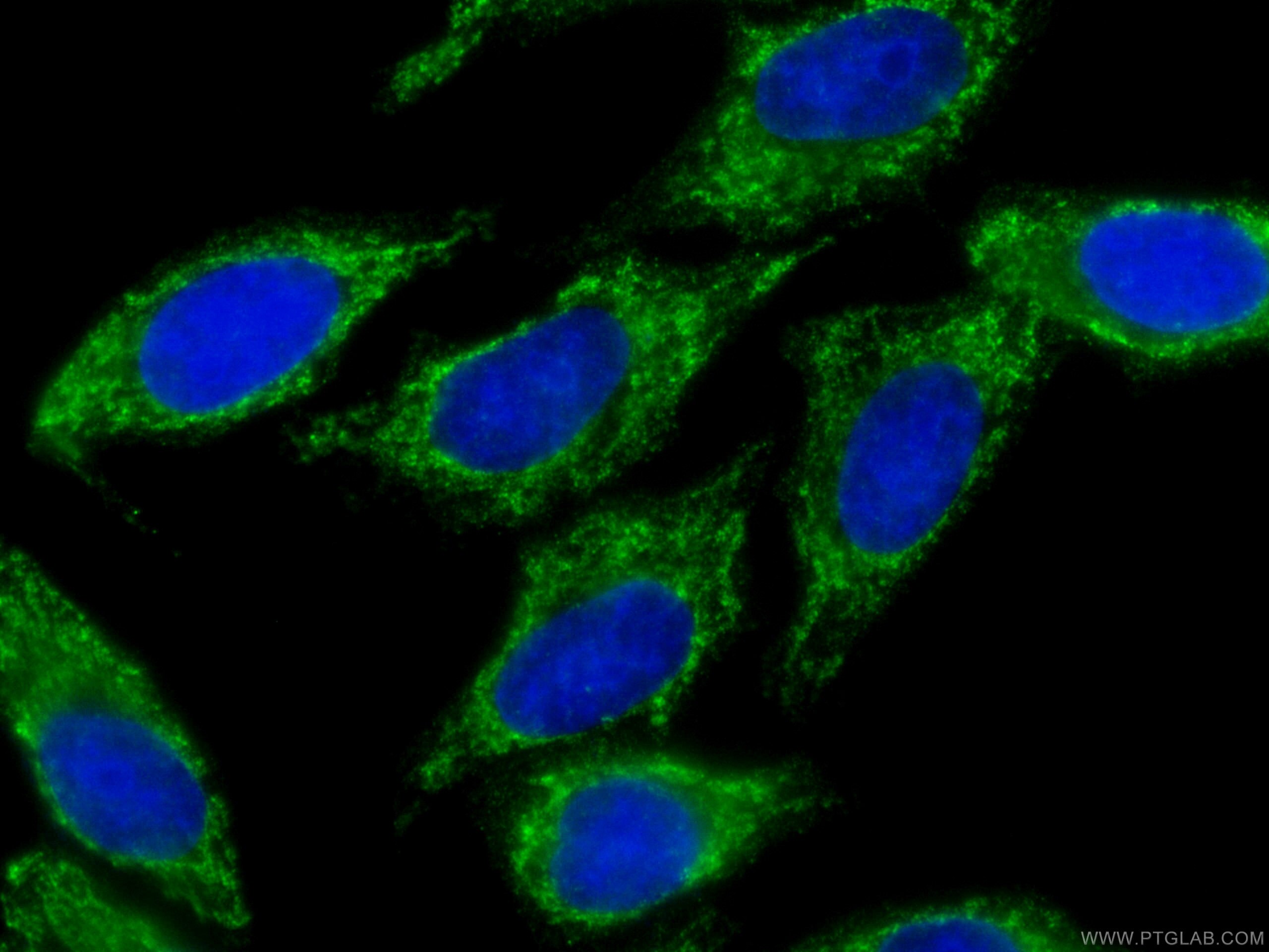 Immunofluorescence (IF) / fluorescent staining of HepG2 cells using CoraLite® Plus 488-conjugated SMN-Exon7 Monoclonal (CL488-60255)