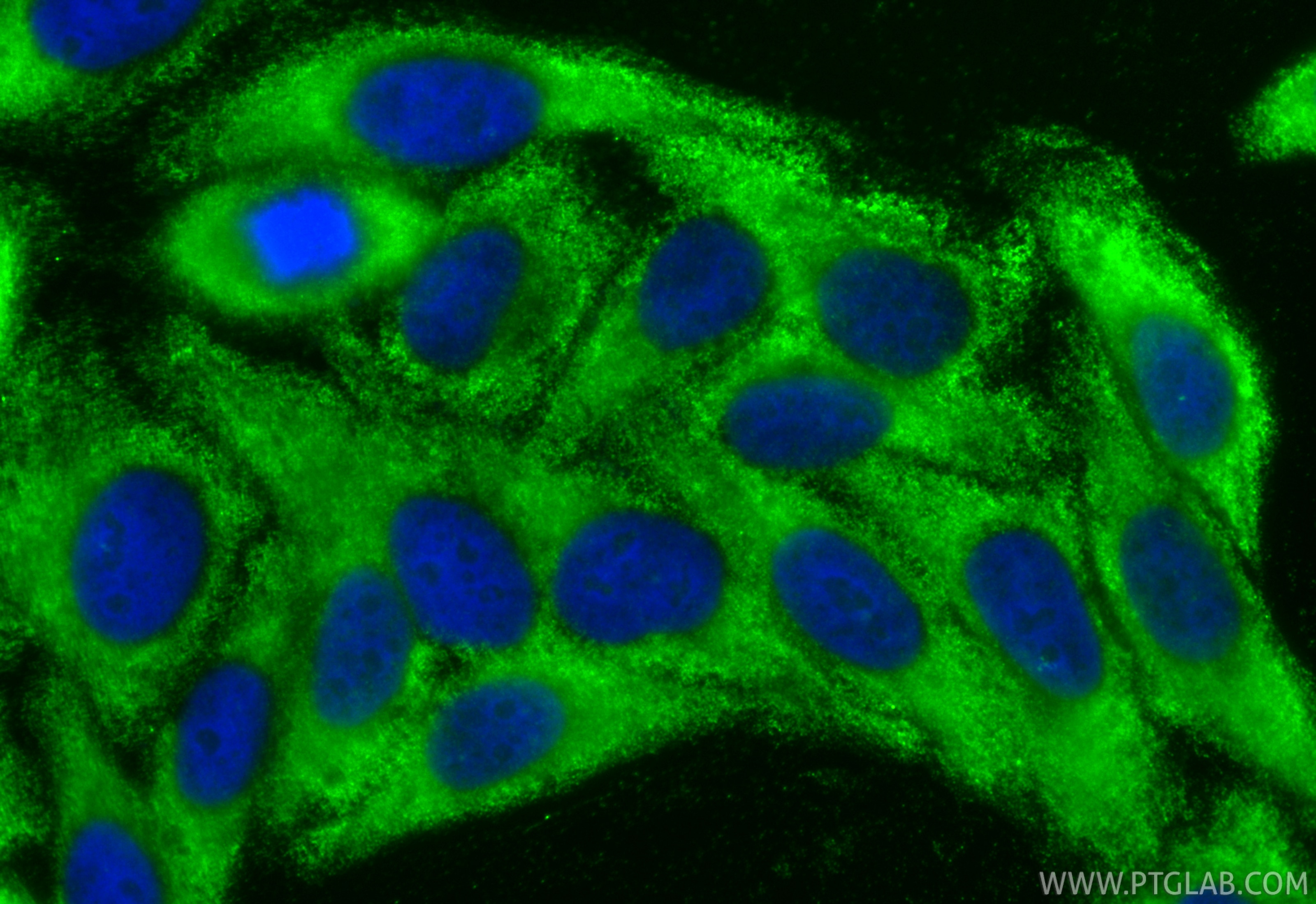 Immunofluorescence (IF) / fluorescent staining of HepG2 cells using CoraLite® Plus 488-conjugated SMN-Exon7 Monoclonal (CL488-60255)