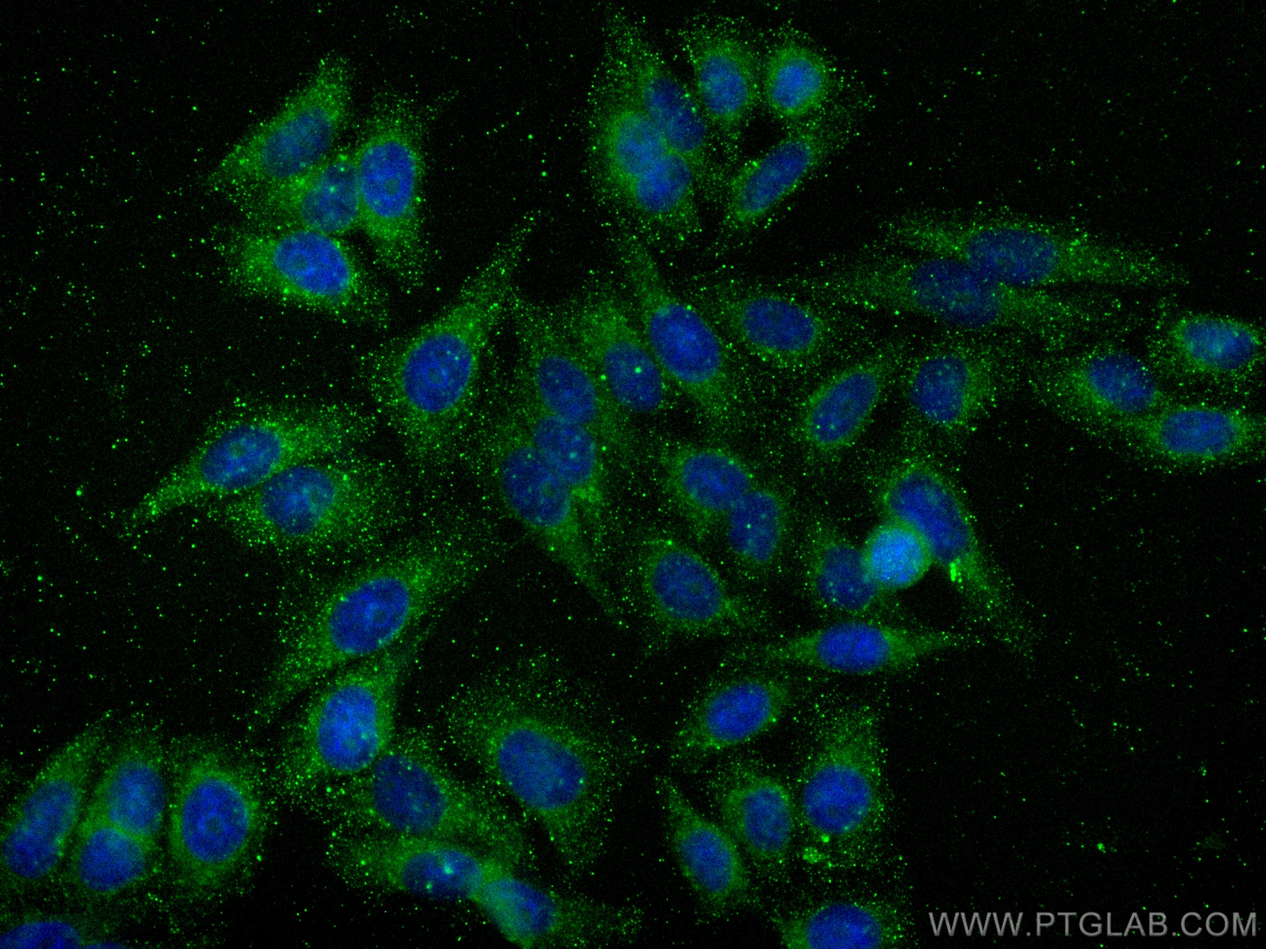 Immunofluorescence (IF) / fluorescent staining of HepG2 cells using SMN-Exon7 Monoclonal antibody (60255-1-Ig)