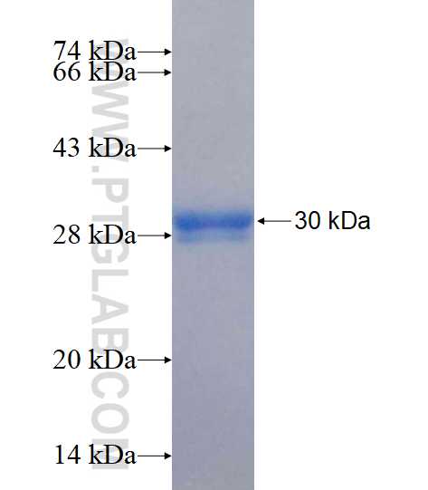 SMN1 fusion protein Ag16615 SDS-PAGE