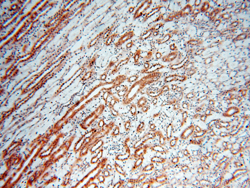Immunohistochemistry (IHC) staining of human kidney tissue using SMN Polyclonal antibody (11708-1-AP)