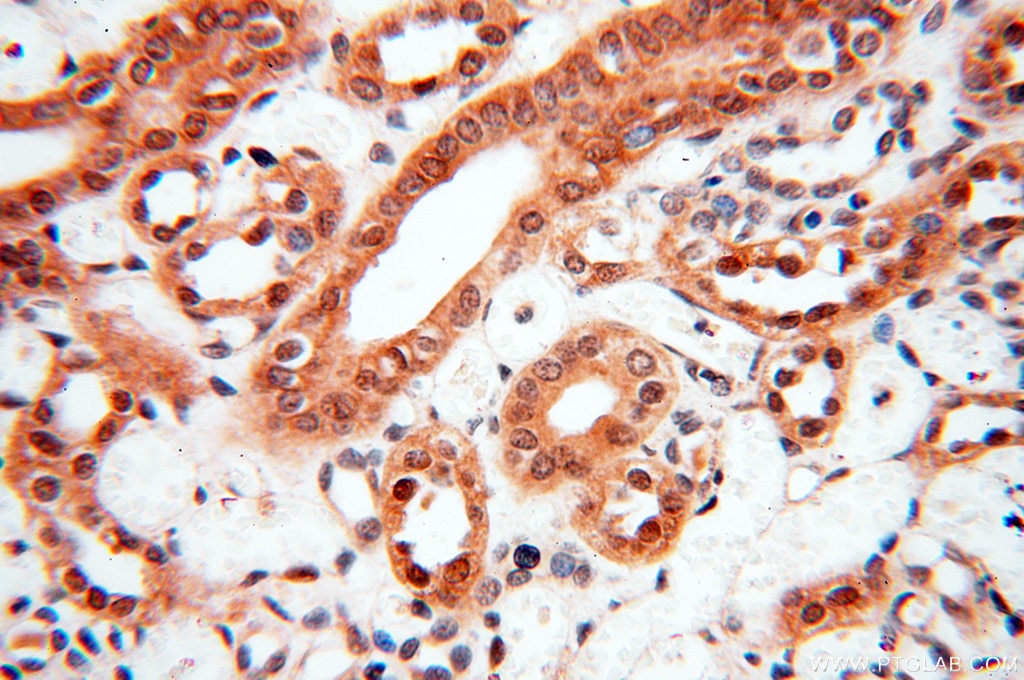 Immunohistochemistry (IHC) staining of human kidney tissue using SMN Polyclonal antibody (11708-1-AP)