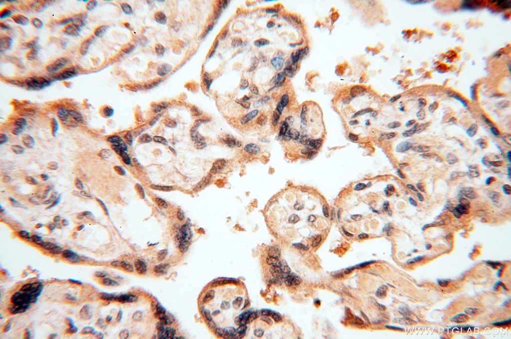 IHC staining of human placenta using 11708-1-AP