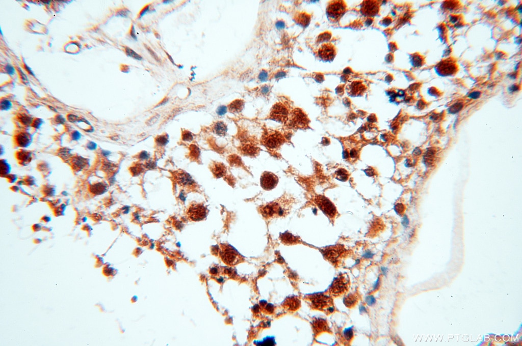 Immunohistochemistry (IHC) staining of human testis tissue using SMN Polyclonal antibody (11708-1-AP)