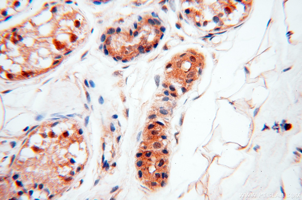 Immunohistochemistry (IHC) staining of human skin tissue using SMN Polyclonal antibody (11708-1-AP)