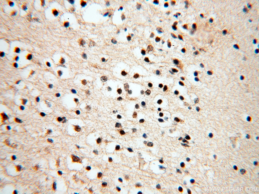 Immunohistochemistry (IHC) staining of human brain tissue using SMN Polyclonal antibody (11708-1-AP)