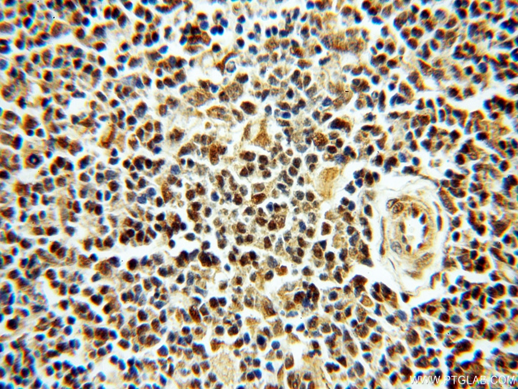 Immunohistochemistry (IHC) staining of human spleen tissue using SMN Polyclonal antibody (11708-1-AP)