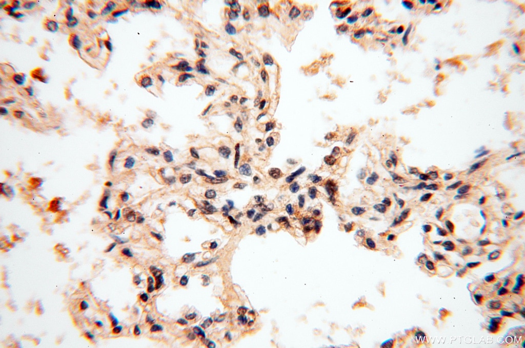 Immunohistochemistry (IHC) staining of human lung tissue using SMN Polyclonal antibody (11708-1-AP)