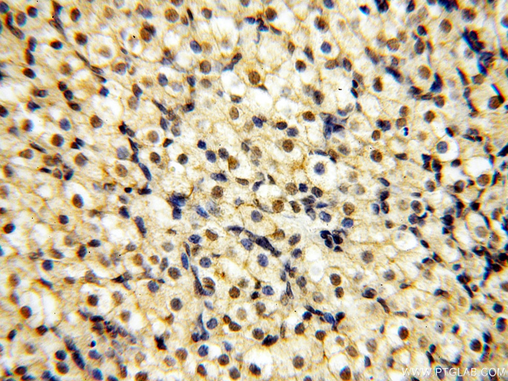 Immunohistochemistry (IHC) staining of human ovary tissue using SMN Polyclonal antibody (11708-1-AP)