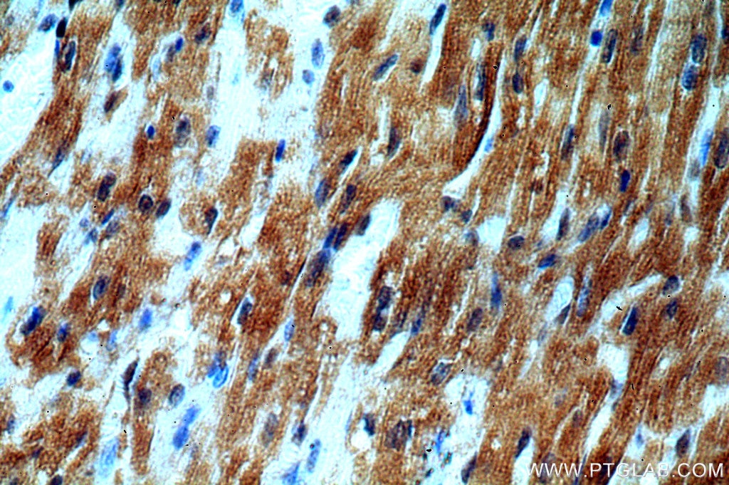 Immunohistochemistry (IHC) staining of human heart tissue using SMN Polyclonal antibody (11708-1-AP)