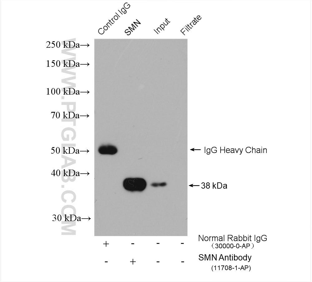 Immunoprecipitation (IP) experiment of HEK-293 cells using SMN Polyclonal antibody (11708-1-AP)