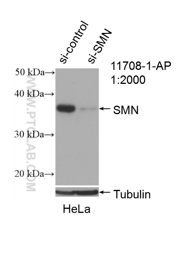 Western Blot (WB) analysis of HeLa cells using SMN Polyclonal antibody (11708-1-AP)