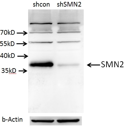 SMN Polyclonal antibody