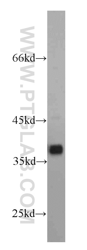 SMN Polyclonal antibody