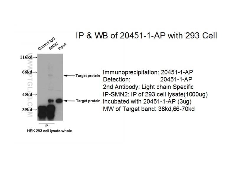 SMN Polyclonal antibody