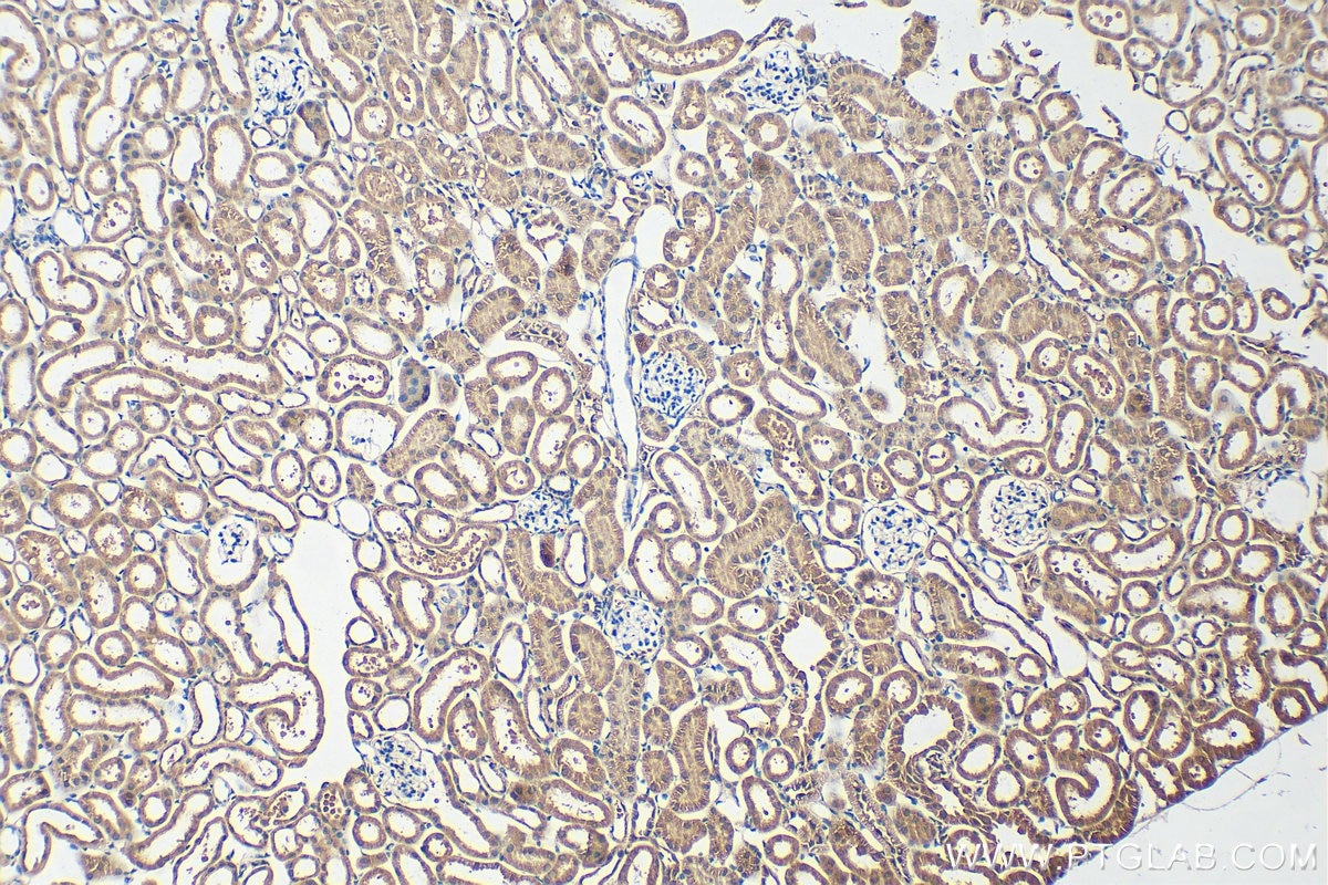 Immunohistochemistry (IHC) staining of mouse kidney tissue using SMN Polyclonal antibody (20451-1-AP)