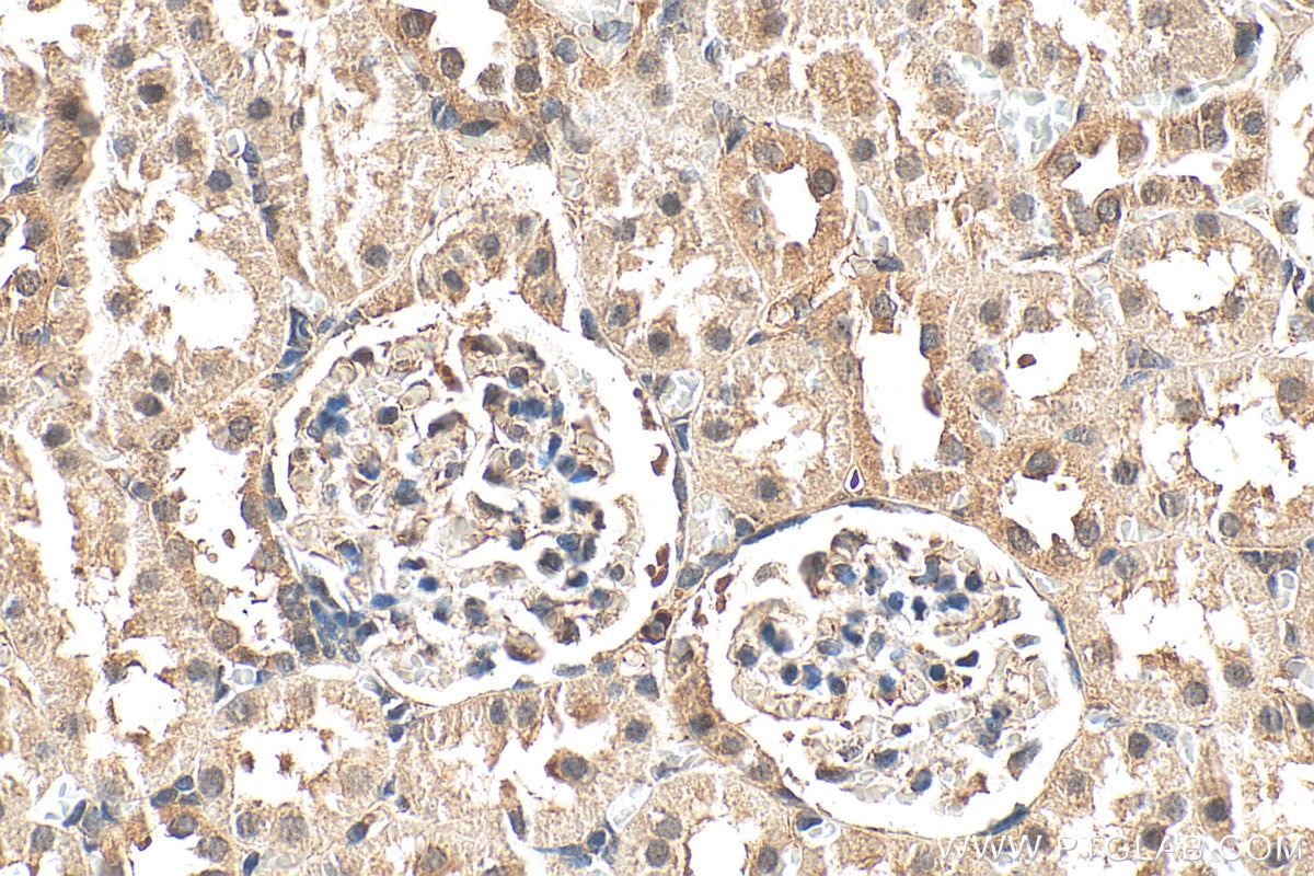 Immunohistochemistry (IHC) staining of rat kidney tissue using SMN Polyclonal antibody (20451-1-AP)