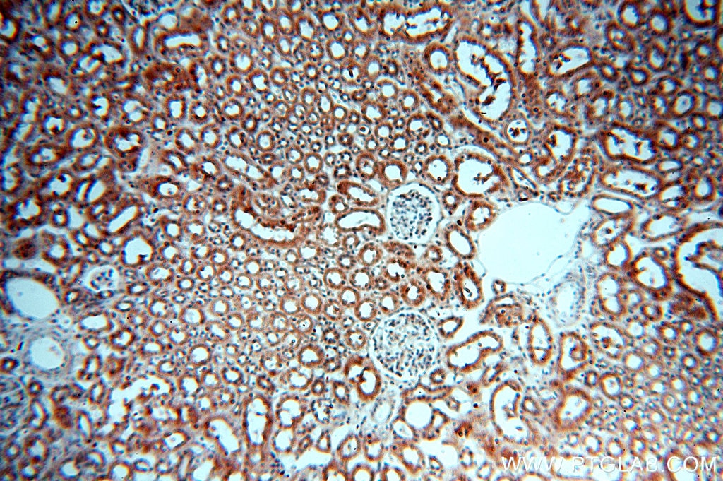 Immunohistochemistry (IHC) staining of human kidney tissue using SMN Polyclonal antibody (20451-1-AP)