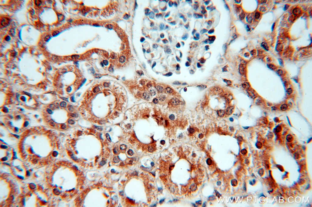 Immunohistochemistry (IHC) staining of human kidney tissue using SMN Polyclonal antibody (20451-1-AP)