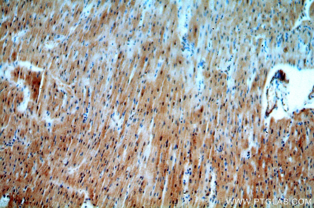 Immunohistochemistry (IHC) staining of human heart tissue using SMN Polyclonal antibody (20451-1-AP)