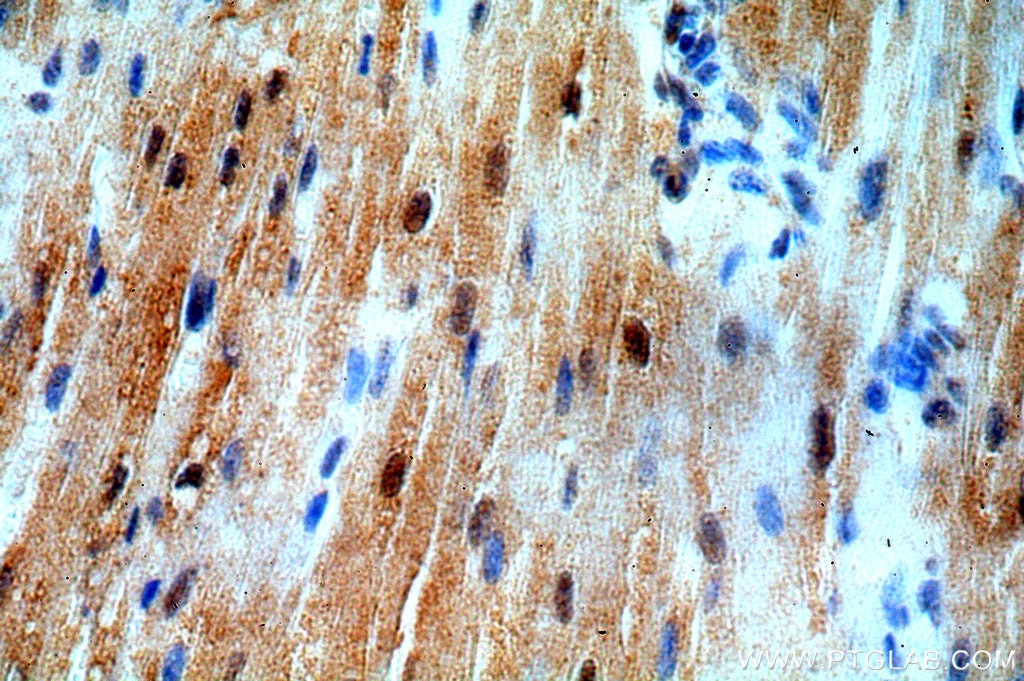 Immunohistochemistry (IHC) staining of human heart tissue using SMN Polyclonal antibody (20451-1-AP)