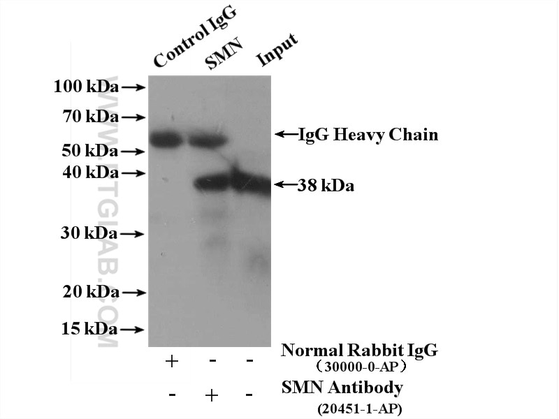 Immunoprecipitation (IP) experiment of HEK-293 cells using SMN Polyclonal antibody (20451-1-AP)