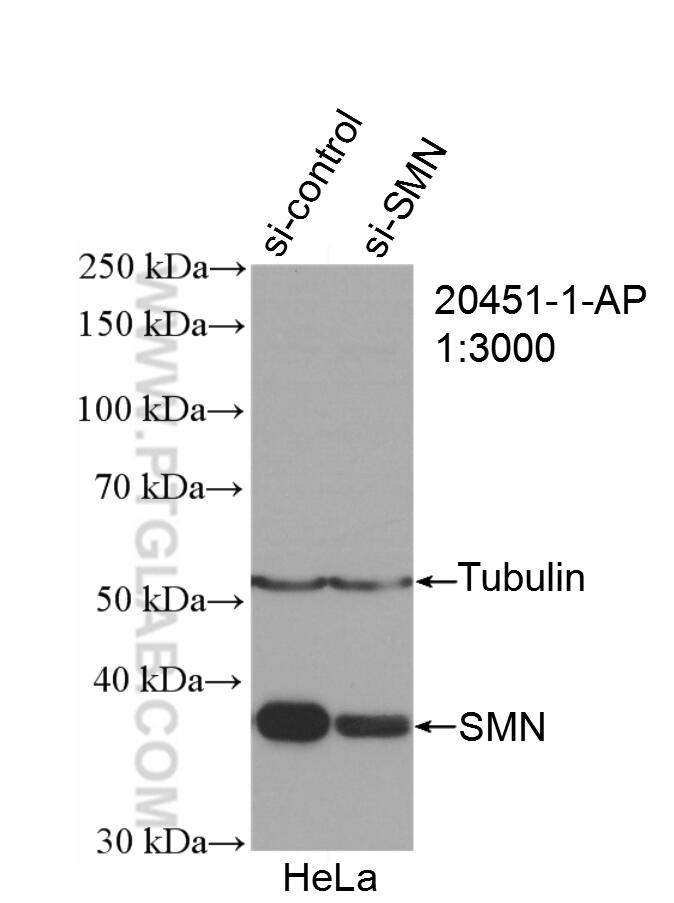 Western Blot (WB) analysis of HeLa cells using SMN Polyclonal antibody (20451-1-AP)