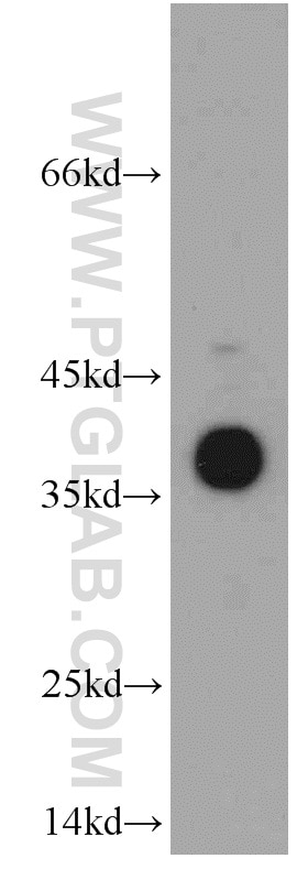 WB analysis of Jurkat using 20451-1-AP