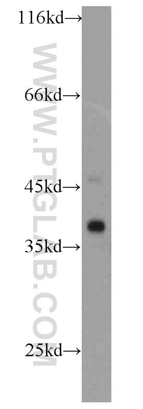 Western Blot (WB) analysis of K-562 cells using SMN Polyclonal antibody (20451-1-AP)