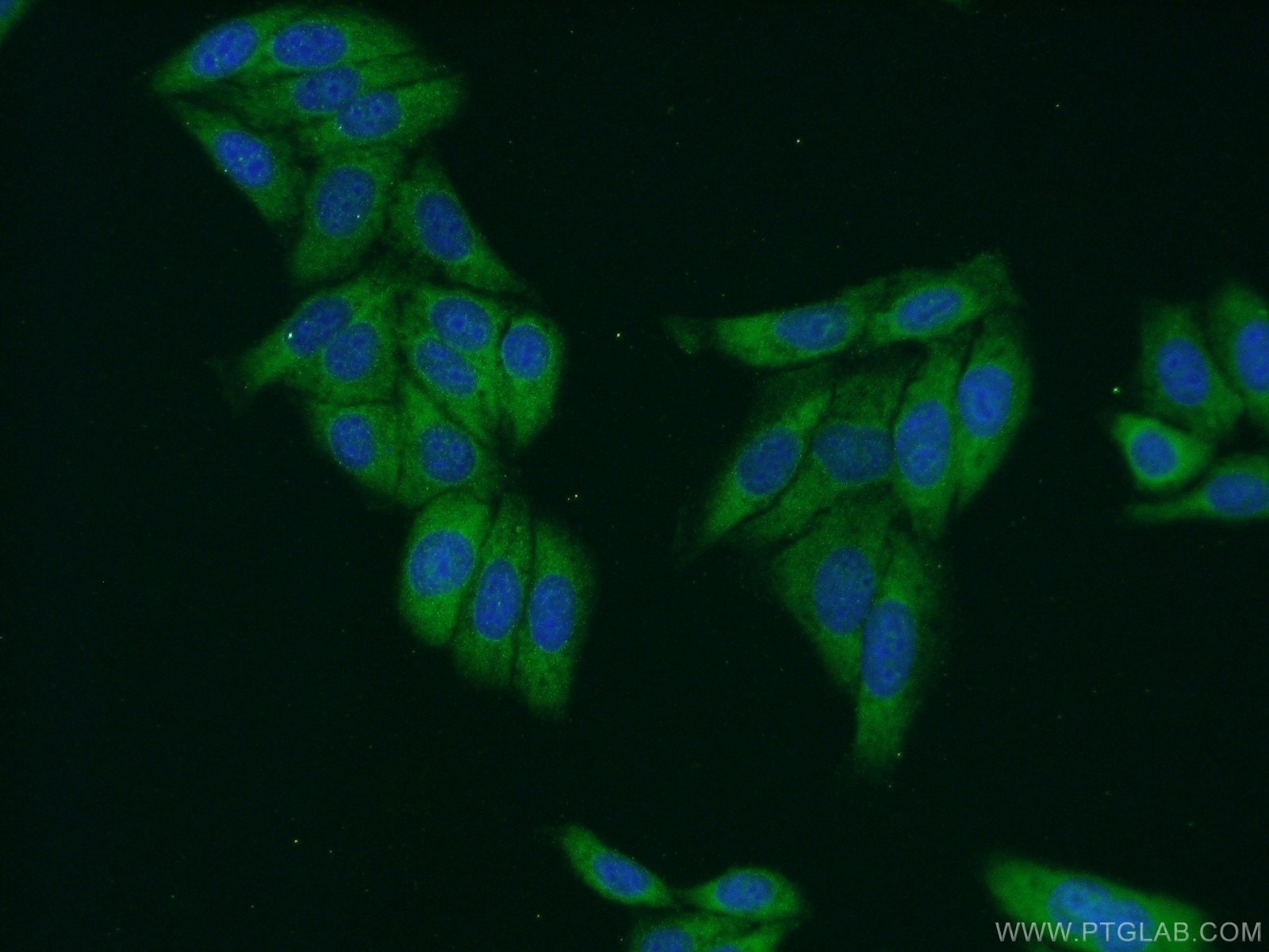Immunofluorescence (IF) / fluorescent staining of HepG2 cells using SMN Polyclonal antibody (22329-1-AP)