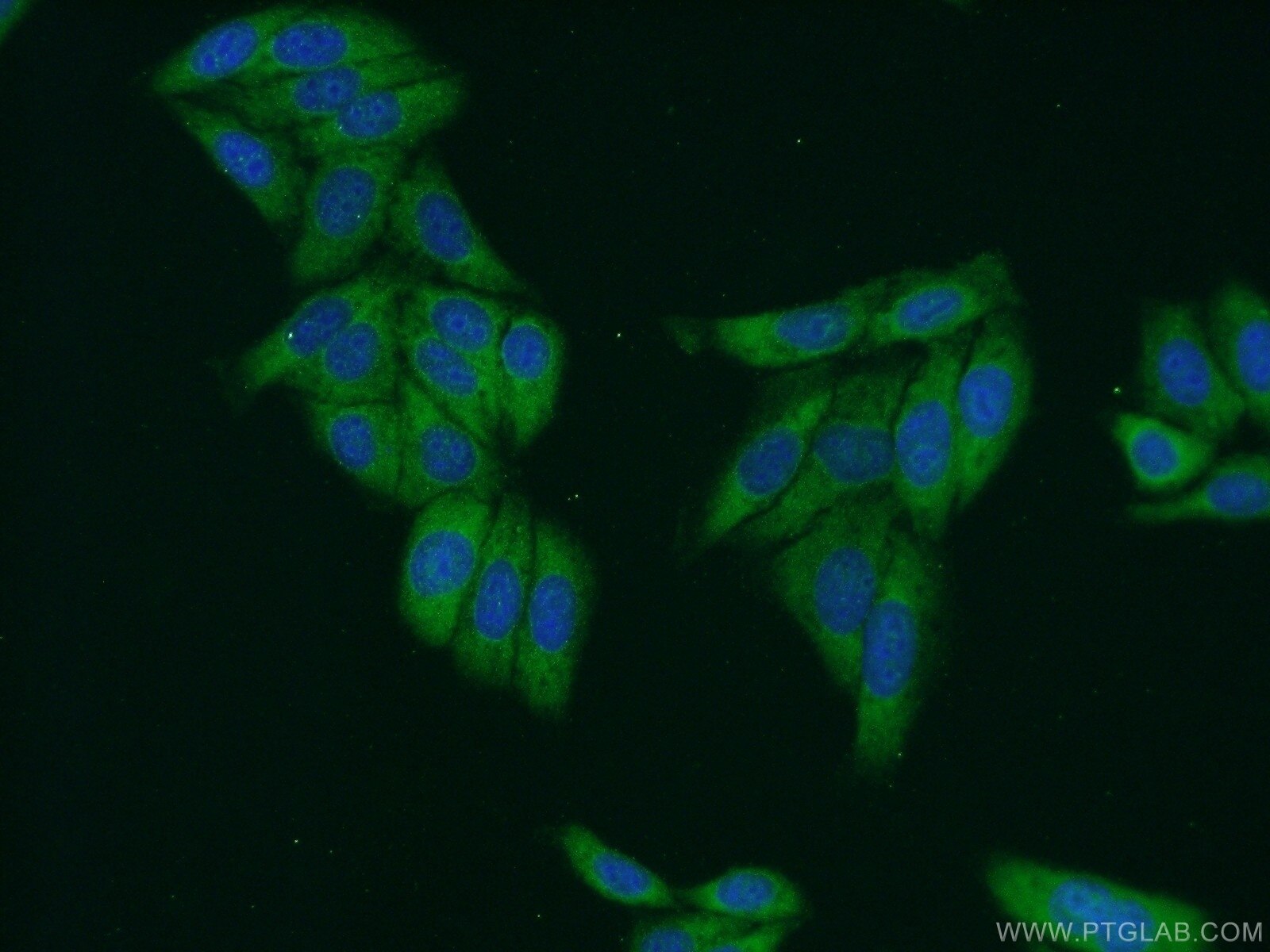 IF Staining of HepG2 using 22329-1-AP