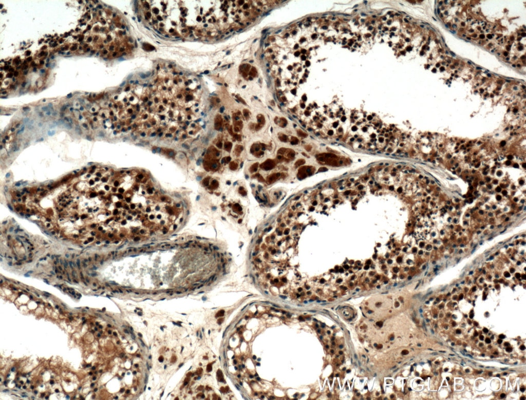 Immunohistochemistry (IHC) staining of human testis tissue using SMN Polyclonal antibody (22329-1-AP)