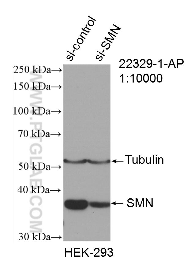 Western Blot (WB) analysis of HEK-293 cells using SMN Polyclonal antibody (22329-1-AP)