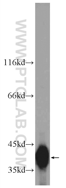 Western Blot (WB) analysis of HEK-293 cells using SMN Polyclonal antibody (22329-1-AP)