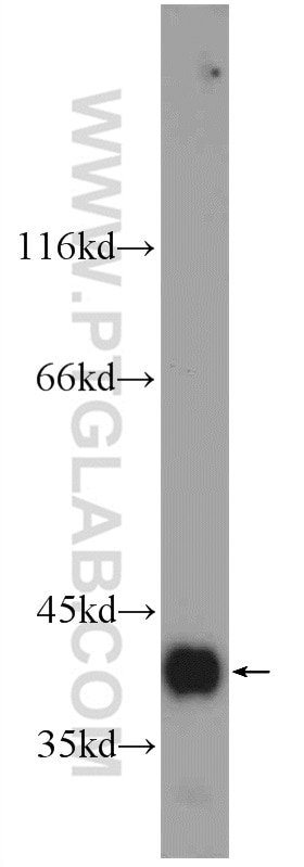 Western Blot (WB) analysis of Jurkat cells using SMN Polyclonal antibody (22329-1-AP)