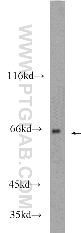 Western Blot (WB) analysis of K-562 cells using SMN Polyclonal antibody (22330-1-AP)